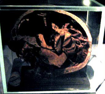 Cross Section of a mummified Skull